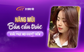 Nâng mũi bán cấu trúc là gì? Ưu điểm của phương pháp này