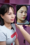 Nâng mũi bị lệch sau bao lâu thì có thể sửa lại?