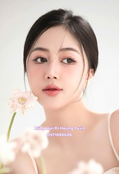 Nâng mũi S-line có đẹp tự nhiên không? Chuyên gia thẩm mỹ giải đáp