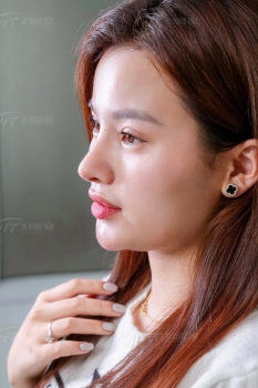 Dr Hoàng Tuấn giải đáp thắc mắc nâng mũi sụn sườn có bị teo lại không