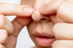 Nâng mũi bị mụn mủ là chuyện bình thường hay bất thường?