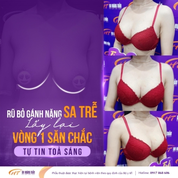 Cách nâng ngực xệ hiệu quả, bí quyết lấy lại vòng 1 săn chắc, đầy đặn và tự nhiên