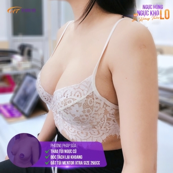 Các phương pháp treo ngực sa trễ tại Dr Hoàng Tuấn