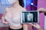 Nâng ngực lép: giải pháp cho vòng 1 đầy đặn, cân đối