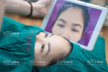 Nhấn mí có ảnh hưởng gì không? Lưu ý cần ghi nhớ