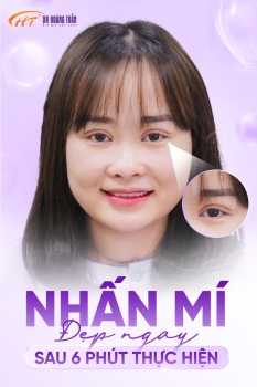 Góc tư vấn: Địa chỉ nhấn mí ở đâu đẹp Hà Nội?