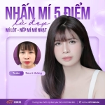 Nhấn mí bị sụp: Nguyên nhân và cách khắc phục