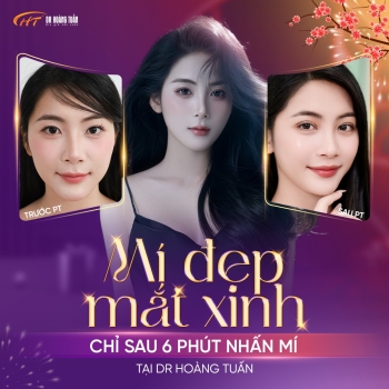 Nhấn mí kiêng nước bao lâu? Bác sĩ Dr Hoàng Tuấn giải đáp