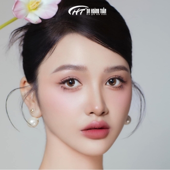 Cắt mí hay nhấn mí tốt hơn? Bác sĩ phân tích để bạn chọn đúng ngay lần đầu