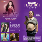 Tôi đã thay đổi như thế đó – Hành trình lột xác của Phương Linh sau 20 dịch vụ tại Dr. Hoàng Tuấn