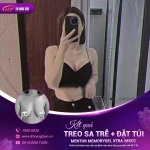 Treo sa trễ đặt túi - Giải pháp cải thiện vòng 1 toàn diện