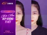 Gọt hàm có vĩnh viễn không? Những điều cần biết trước khi thực hiện
