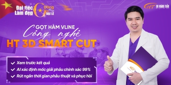 Bước tiến mới của HT 3D Smart Cut trong phẫu thuật gọt hàm, hạ gò má